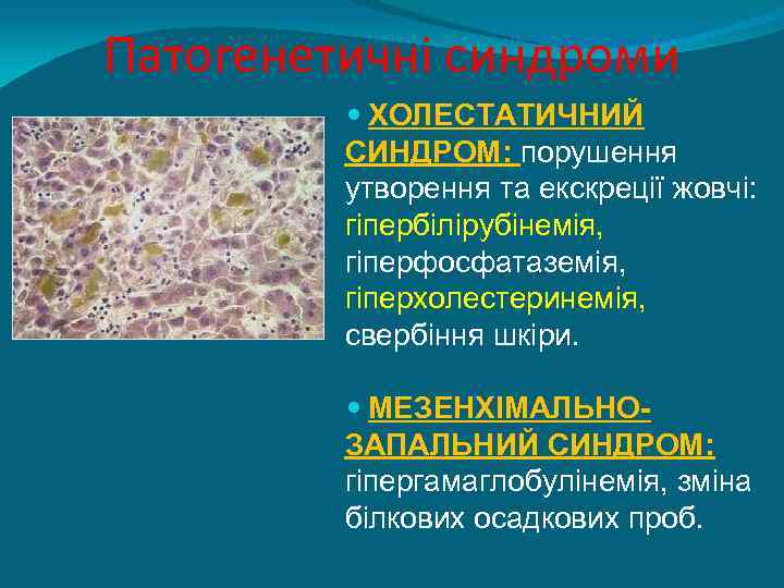 Патогенетичні синдроми ХОЛЕСТАТИЧНИЙ СИНДРОМ: порушення утворення та екскреції жовчі: гіпербілірубінемія, гіперфосфатаземія, гіперхолестеринемія, свербіння шкіри.