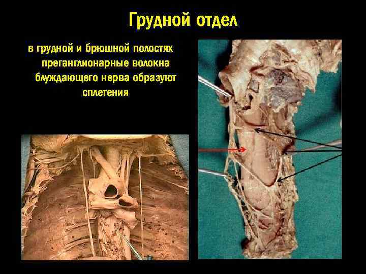 Грудной отдел в грудной и брюшной полостях преганглионарные волокна блуждающего нерва образуют сплетения 