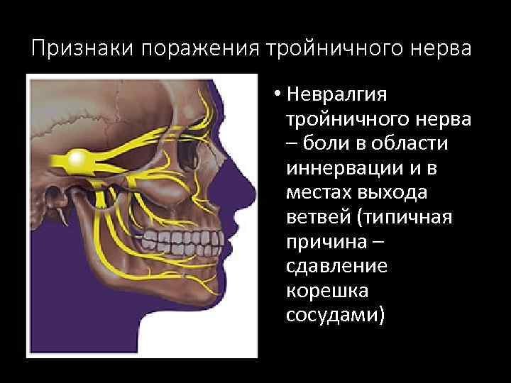 Признаки поражения тройничного нерва • Невралгия тройничного нерва – боли в области иннервации и