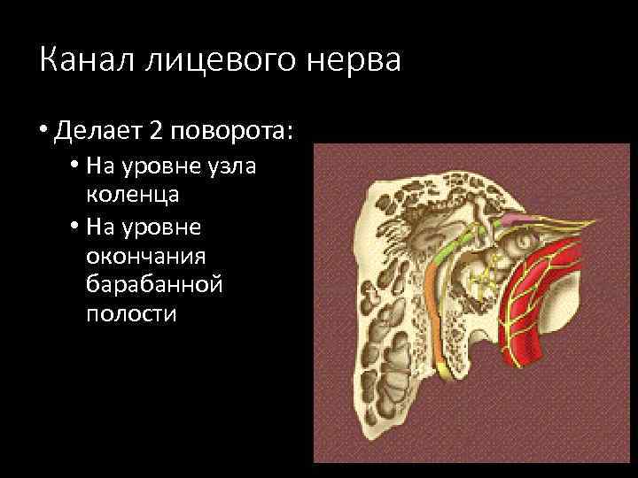 Канал лицевого нерва • Делает 2 поворота: • На уровне узла коленца • На