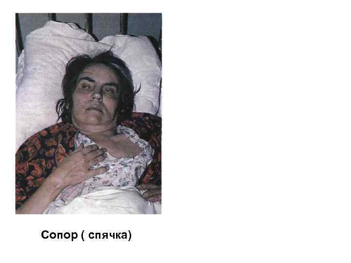 Сопор ( спячка) 