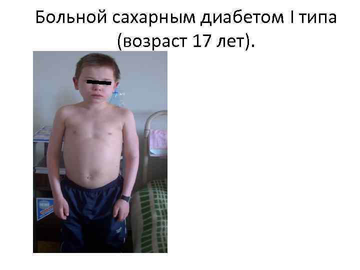 Больной сахарным диабетом I типа (возраст 17 лет). 