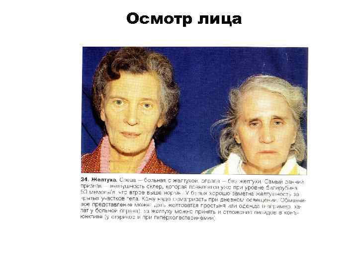 Осмотр лица 