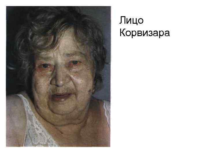 Лицо Корвизара 