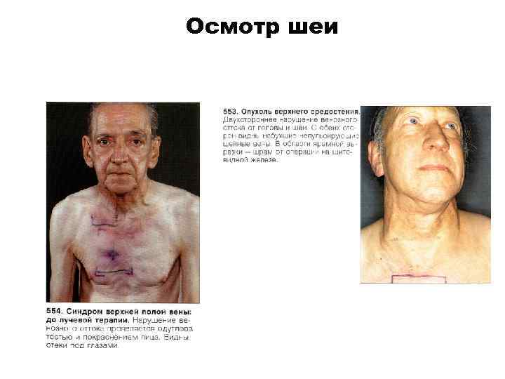 Осмотр шеи 