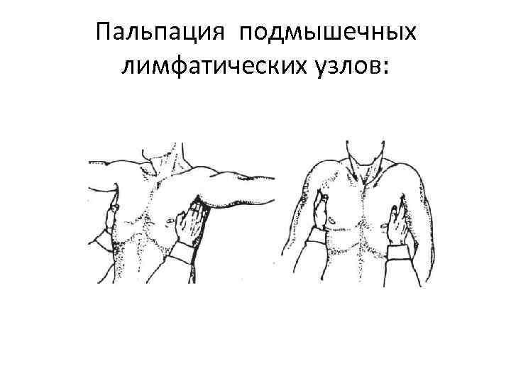 Осмотр пропедевтика. Пальпация периферических лимфоузлов алгоритм. Пальпация лимфатических узлов пропедевтика. Пальпация молочных желез и периферических лимфатических узлов.. Пальпация лимфатических узлов пропедевтика внутренних.