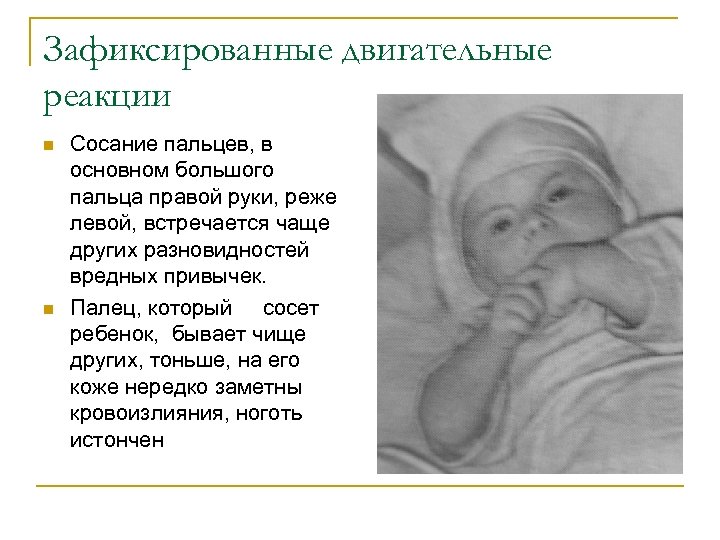 Зафиксированные двигательные реакции n n Сосание пальцев, в основном большого пальца правой руки, реже