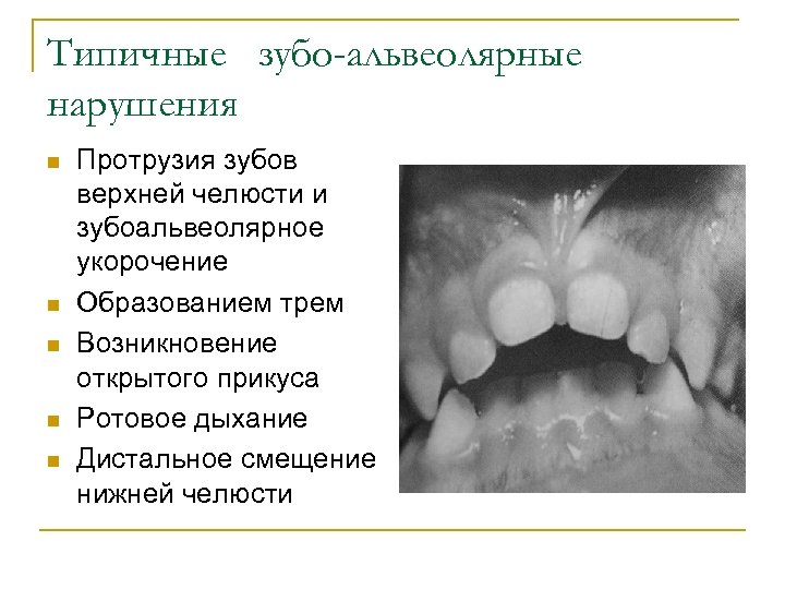 Типичные зубо-альвеолярные нарушения n n n Протрузия зубов верхней челюсти и зубоальвеолярное укорочение Образованием