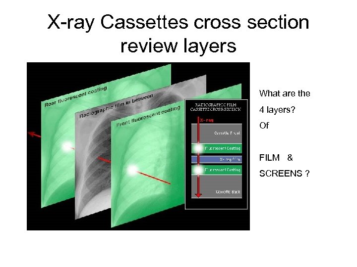 X-ray Cassettes cross section review layers What are the 4 layers? Of FILM &