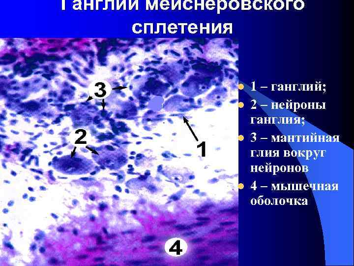 Ганглий мейснеровского сплетения l l 1 – ганглий; 2 – нейроны ганглия; 3 –