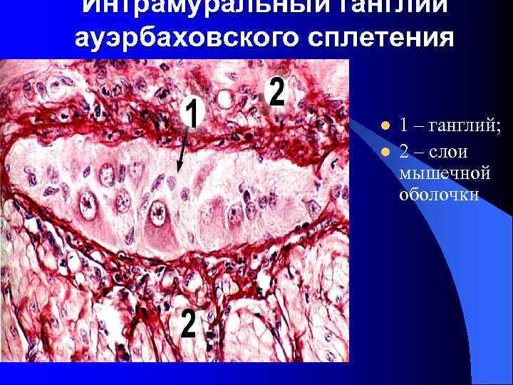 Интрамуральный ганглий ауэрбаховского сплетения l l 1 – ганглий; 2 – слои мышечной оболочки