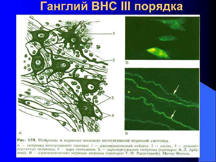 Ганглий ВНС III порядка 