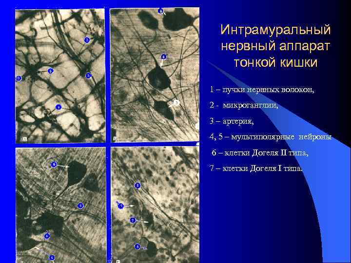 Интрамуральный нервный аппарат тонкой кишки 1 – пучки нервных волокон, 2 - микроганглии, 3