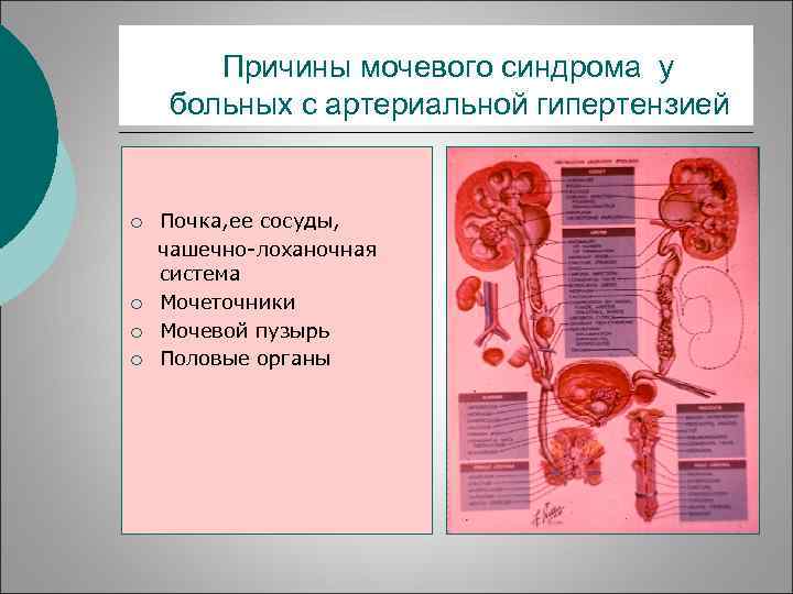 Причины мочевого синдрома у больных с артериальной гипертензией ¡ ¡ Почка, ее сосуды, чашечно-лоханочная