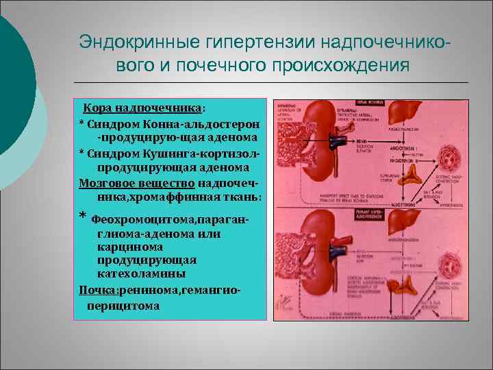 Эндокринные гипертензии надпочечникового и почечного происхождения Кора надпочечника: * Синдром Конна-альдостерон -продуцирую-щая аденома *