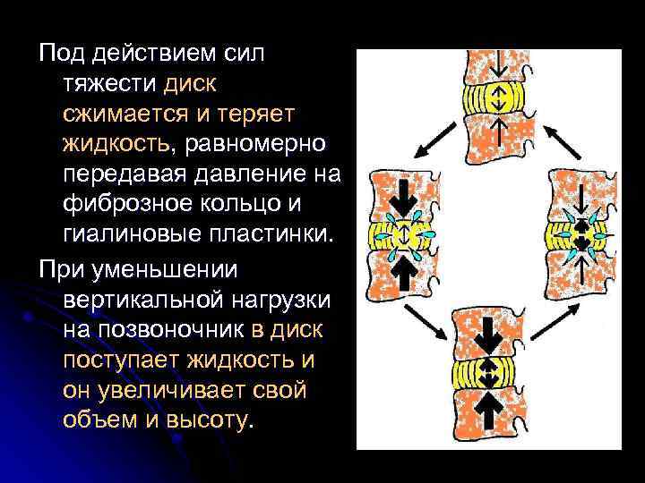 Под действием сил тяжести диск сжимается и теряет жидкость, равномерно передавая давление на фиброзное