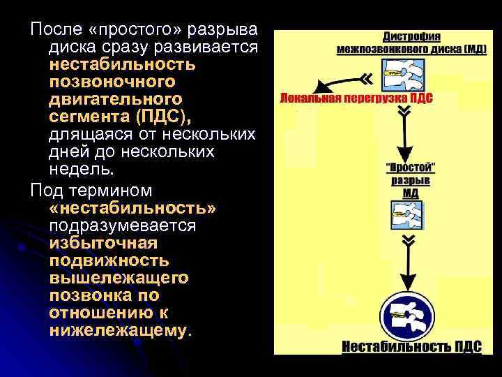 После «простого» разрыва диска сразу развивается нестабильность позвоночного двигательного сегмента (ПДС), длящаяся от нескольких