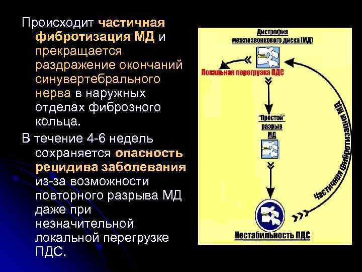 Происходит частичная фибротизация МД и прекращается раздражение окончаний синувертебрального нерва в наружных отделах фиброзного