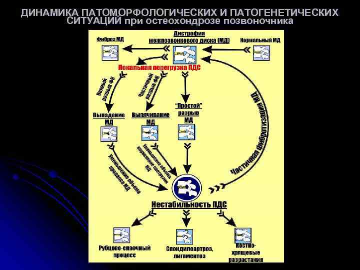 ДИНАМИКА ПАТОМОРФОЛОГИЧЕСКИХ И ПАТОГЕНЕТИЧЕСКИХ СИТУАЦИЙ при остеохондрозе позвоночника 