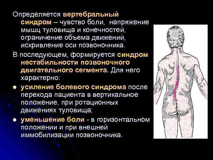 Определяется вертебральный синдром – чувство боли, напряжение мышц туловища и конечностей, ограничение объема движений,