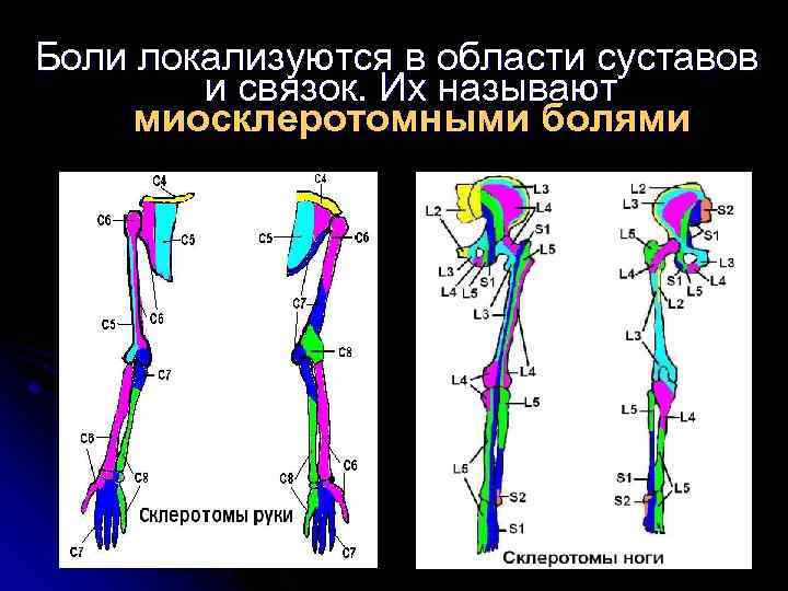 Боли локализуются в области суставов и связок. Их называют миосклеротомными болями 