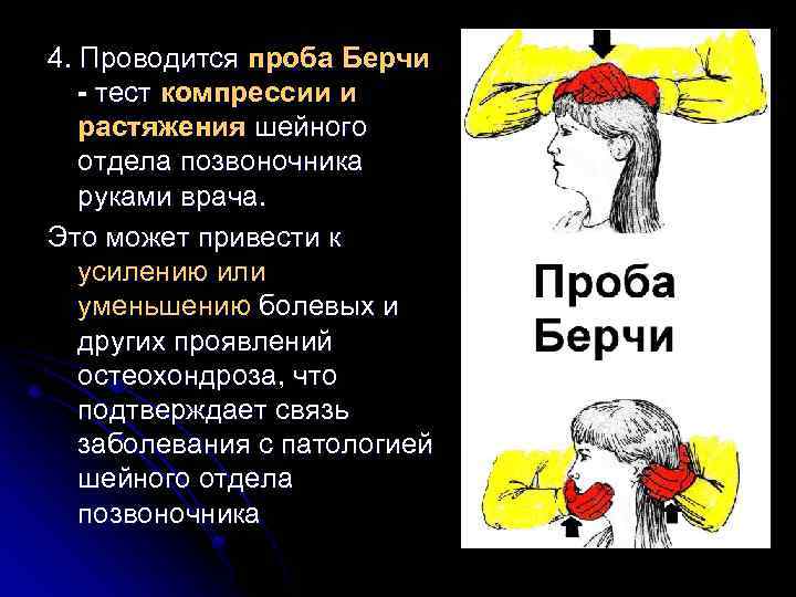 4. Проводится проба Берчи - тест компрессии и растяжения шейного отдела позвоночника руками врача.