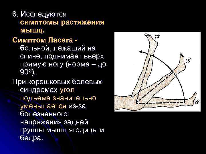 6. Исследуются симптомы растяжения мышц. Симптом Ласега больной, лежащий на спине, поднимает вверх прямую