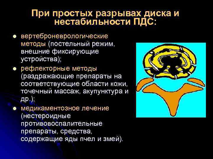 При простых разрывах диска и нестабильности ПДС: l l l вертеброневрологические методы (постельный режим,