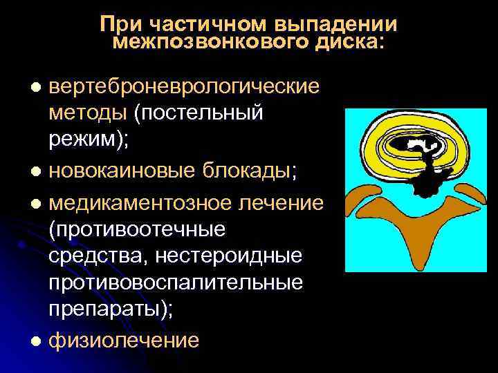 При частичном выпадении межпозвонкового диска: вертеброневрологические методы (постельный режим); l новокаиновые блокады; l медикаментозное