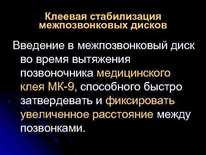 Клеевая стабилизация межпозвонковых дисков Введение в межпозвонковый диск во время вытяжения позвоночника медицинского клея