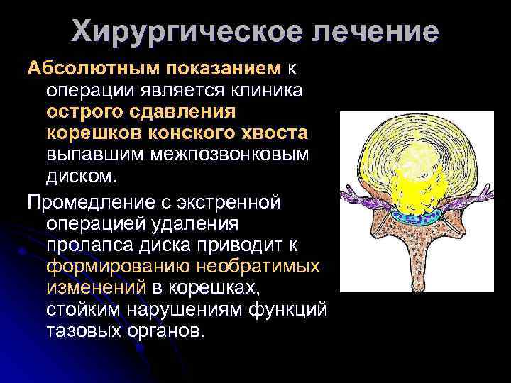 Хирургическое лечение Абсолютным показанием к операции является клиника острого сдавления корешков конского хвоста выпавшим