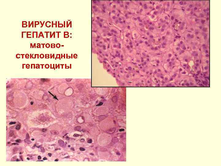 Планшеты иммунологические вид 327170