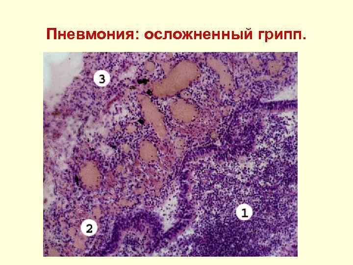 Вирусные инфекции фото