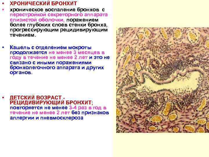  • • ХРОНИЧЕСКИЙ БРОНХИТ хроническое воспаление бронхов с перестройкой секреторного аппарата слизистой оболочки,