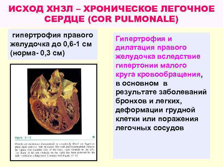 Хронические неспецифические заболевания легких презентация