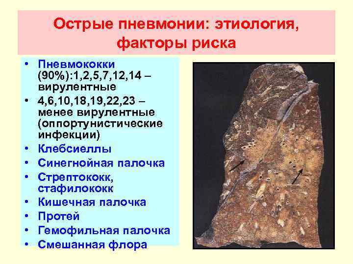 Острые пневмонии: этиология, факторы риска • Пневмококки (90%): 1, 2, 5, 7, 12, 14