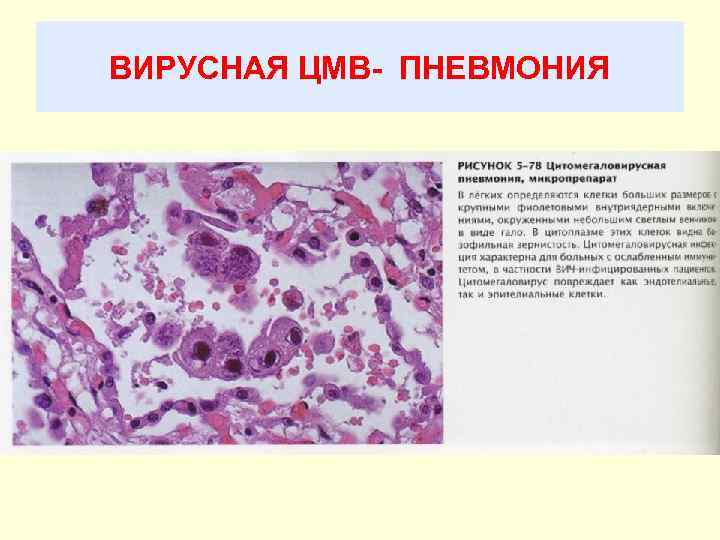 Болезни органов дыхания патанатомия презентация