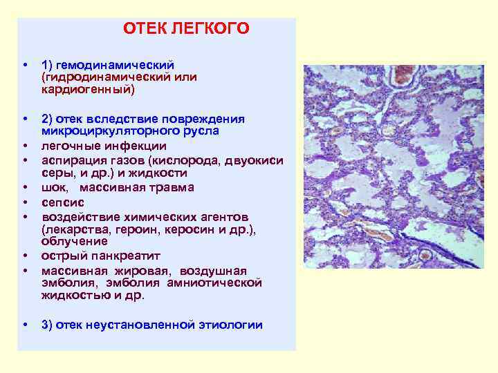 Отек легких карта