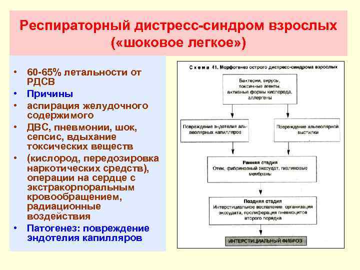 Респираторный дистресс-синдром взрослых ( «шоковое легкое» ) • 60 -65% летальности от РДСВ •