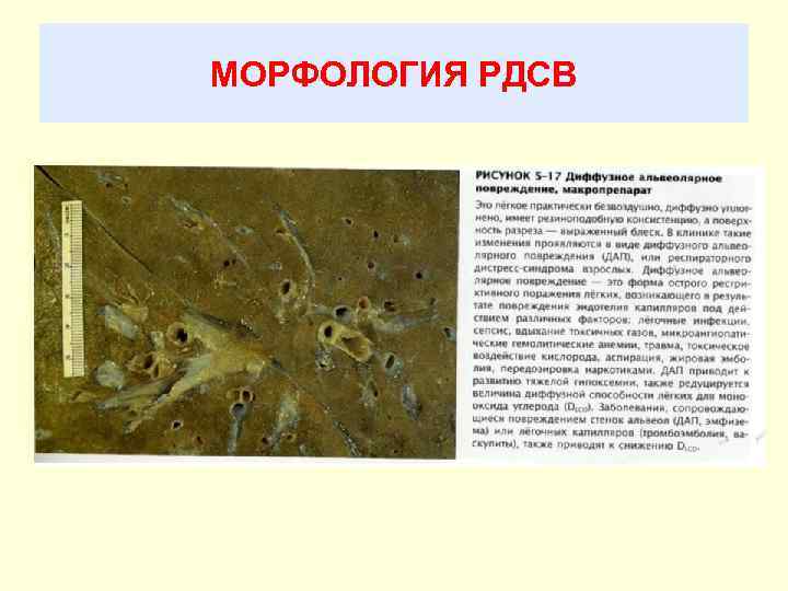 МОРФОЛОГИЯ РДСВ 