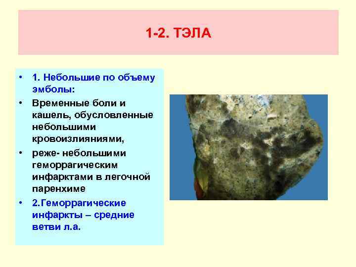 1 -2. ТЭЛА • 1. Небольшие по объему эмболы: • Временные боли и кашель,