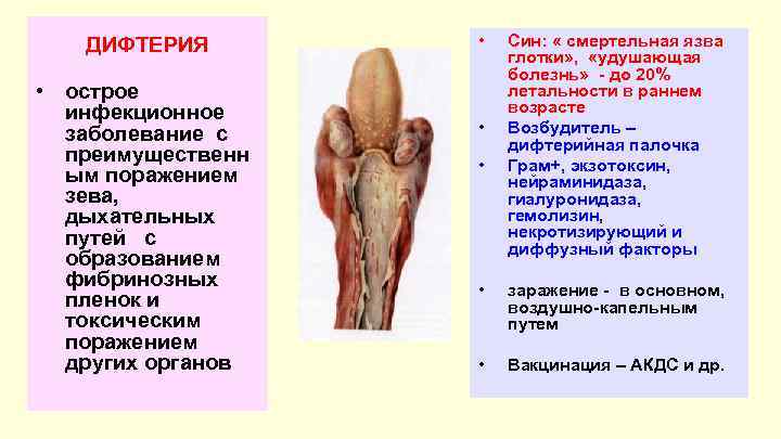 Презентация по педиатрии дифтерия