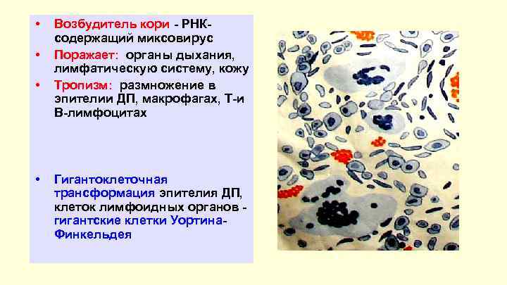 Возбудитель кори. Корь возбудитель инфекции. Гигантские клетки при кори. Клетки Уортина Финкельдея корь.