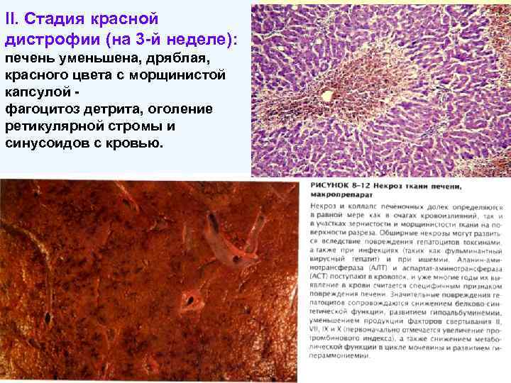 Глаза при болезни печени фото