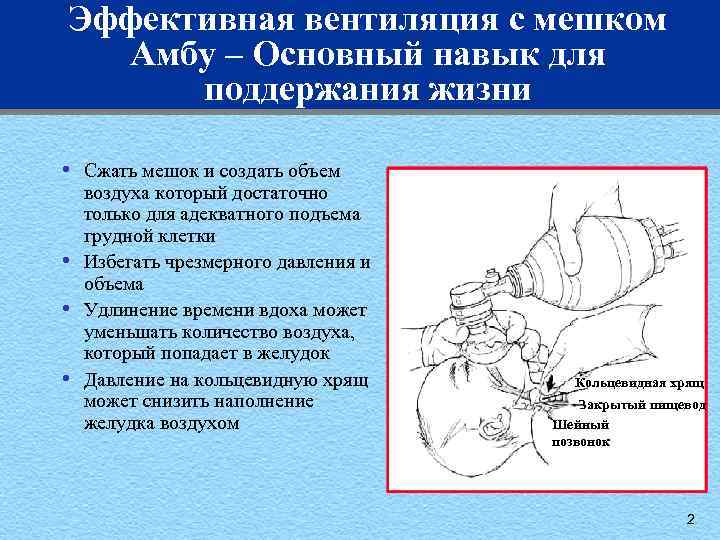 Восстановление дыхательных путей последовательность