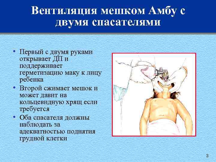 Вентиляция мешком Амбу с двумя спасателями • • • Первый с двумя руками открывает