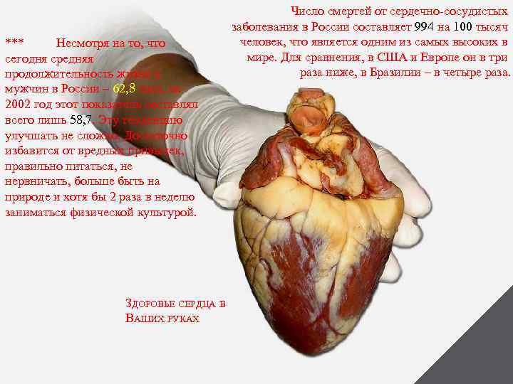 *** Несмотря на то, что сегодня средняя продолжительность жизни у мужчин в России –