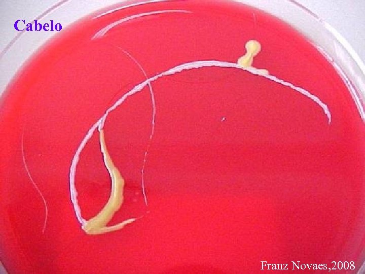 Cabelo Franz Novaes, 2008 