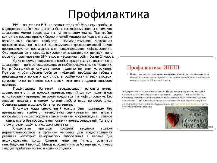 Профилактика ВИЧ - лечится ли ВИЧ на ранних стадиях? Все люди, особенно медицинские работники,