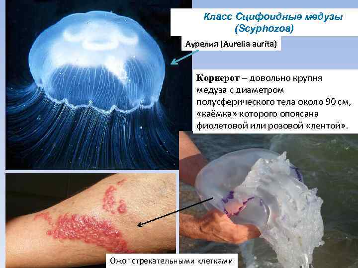 Класс Сцифоидные медузы (Scyphozoa) Аурелия (Aurelia aurita) Корнерот – довольно крупня медуза с диаметром